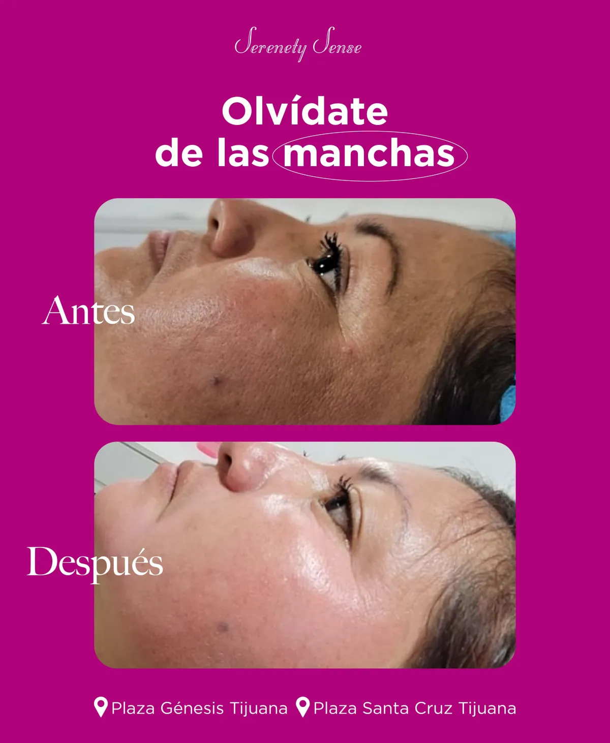 neutrogena deep clean soft tube