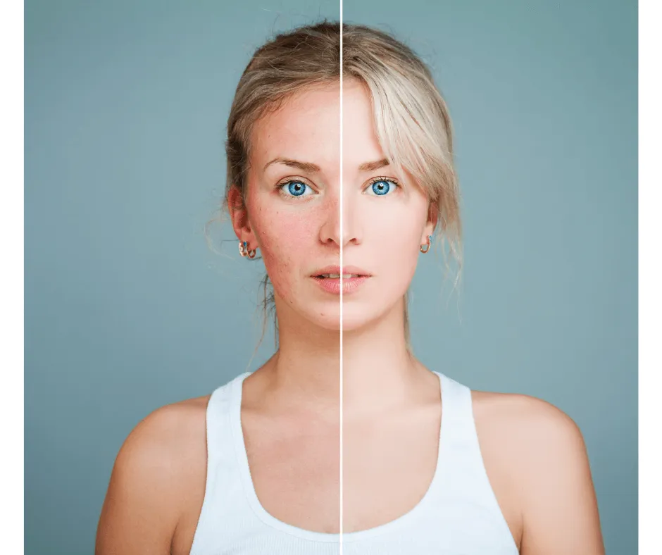 Model - Before and After photo