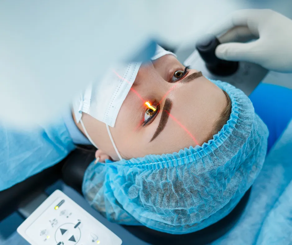 laser eye surgery