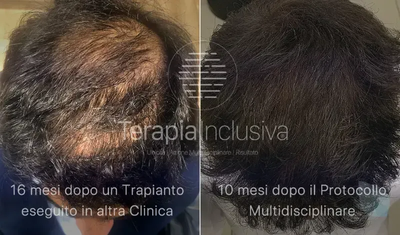 Prima e Dopo