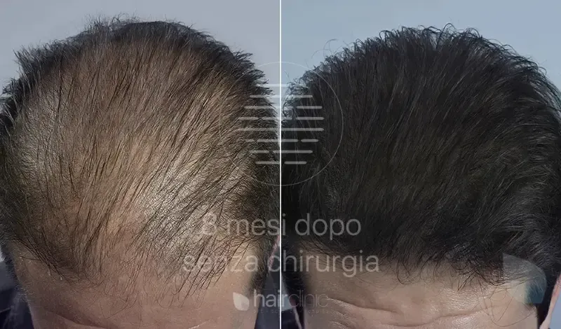 Prima e Dopo