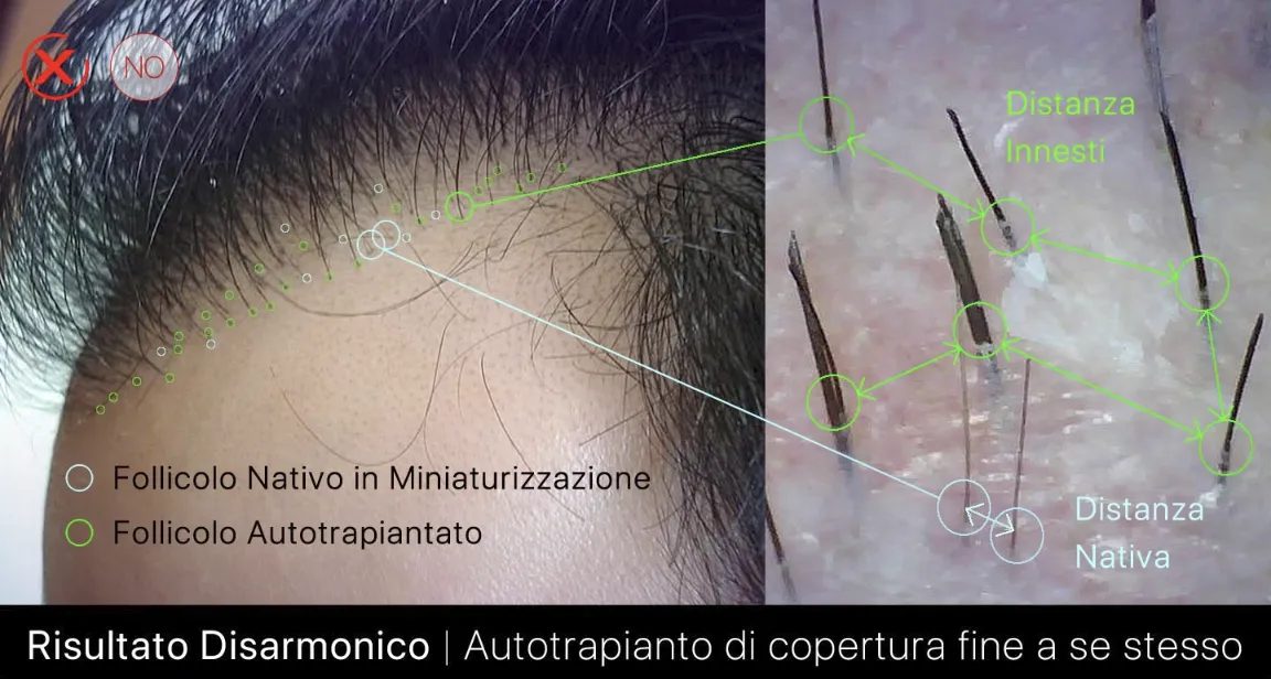 Risultato Disarmonico