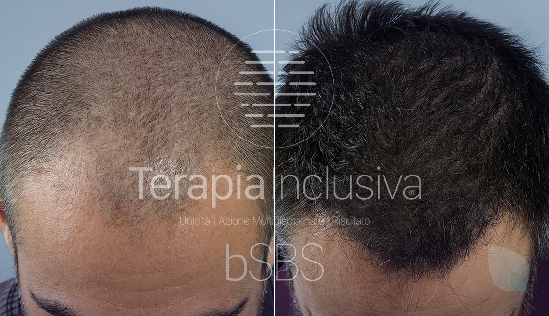 Prima e Dopo