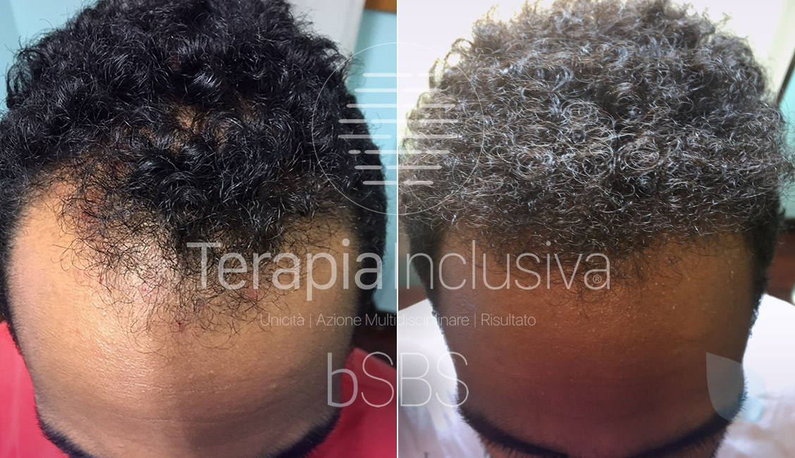 Prima e Dopo