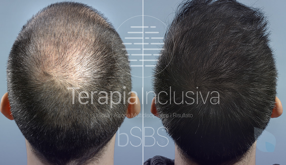 Prima e Dopo