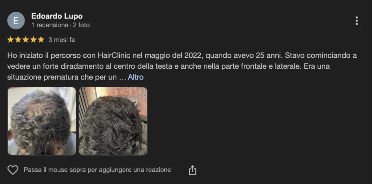 Hairclinic recensioni positive negative