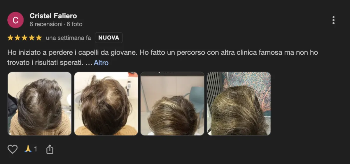 Hairclinic recensioni positive negative