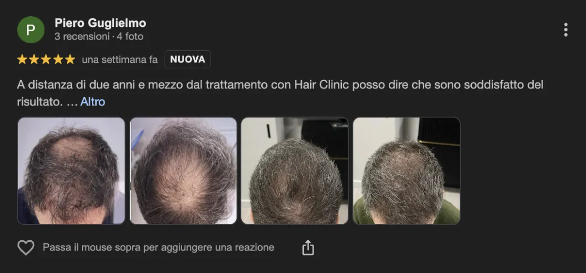 Hairclinic recensioni positive negative