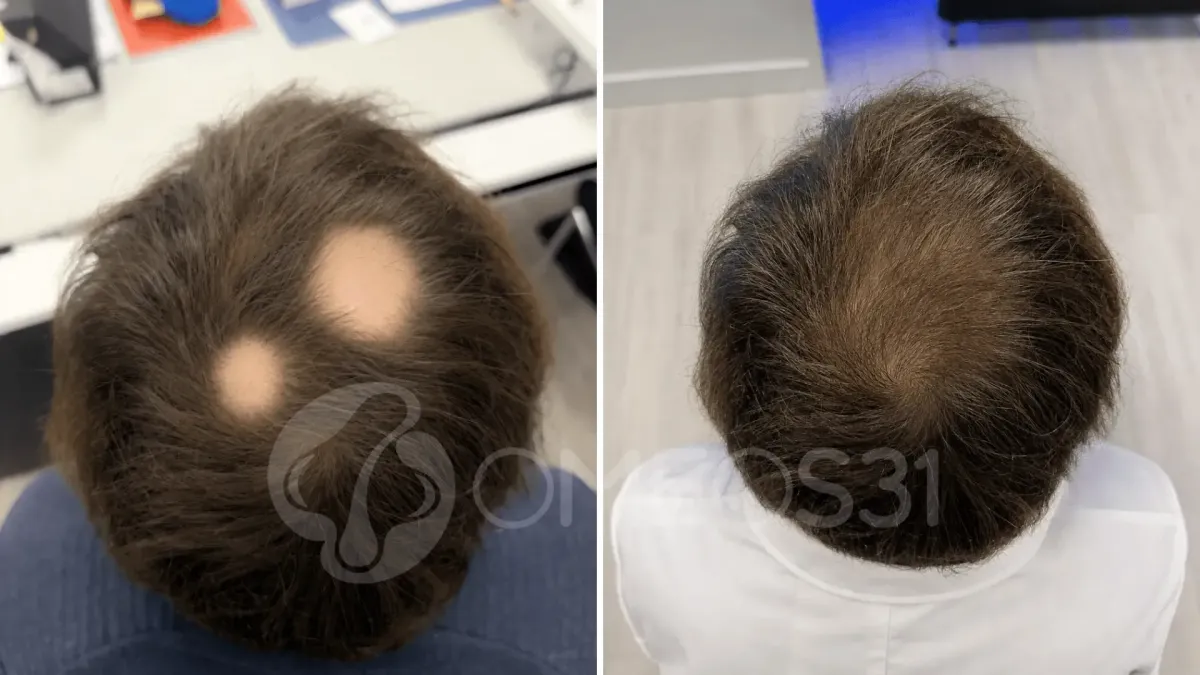 Prima e Dopo