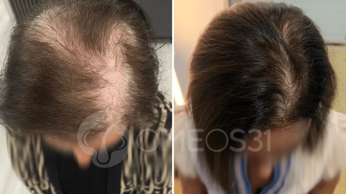 Prima e Dopo