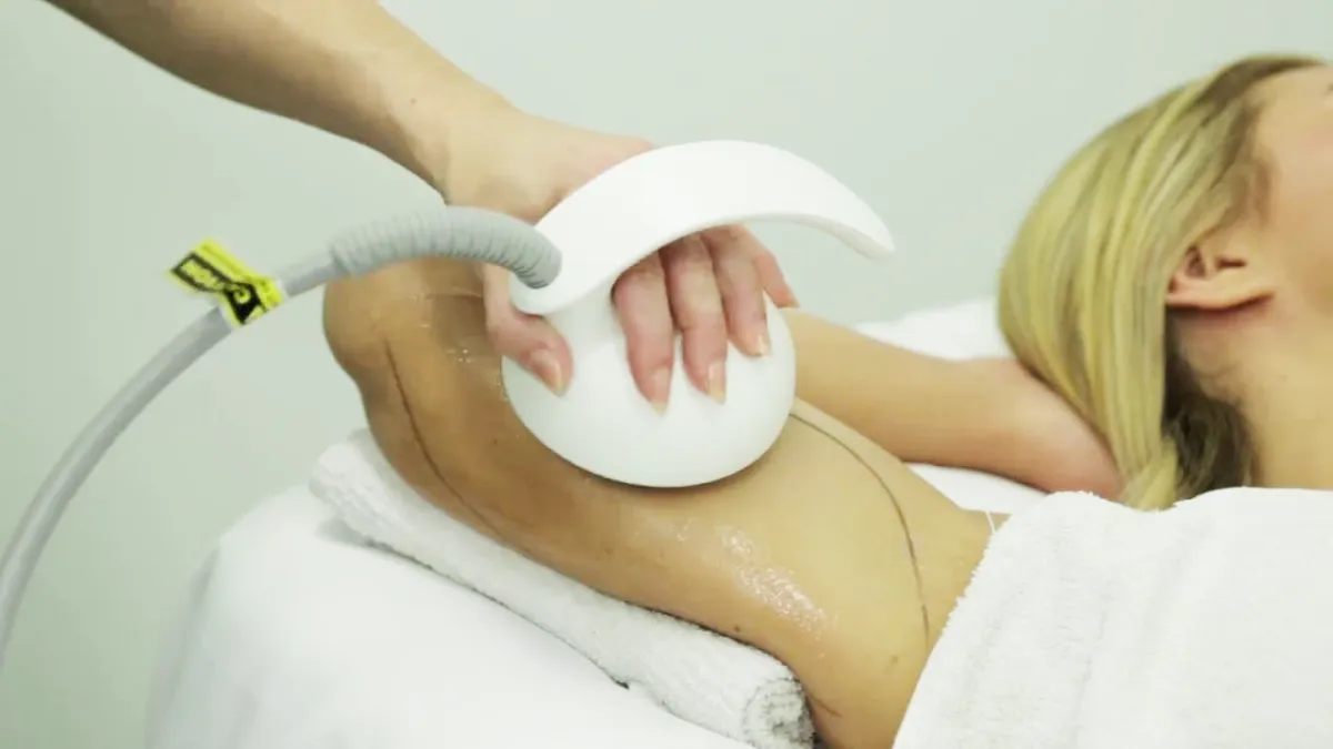 What You Need To Know About Venus Bliss™ Slim & Smooth Treatments
