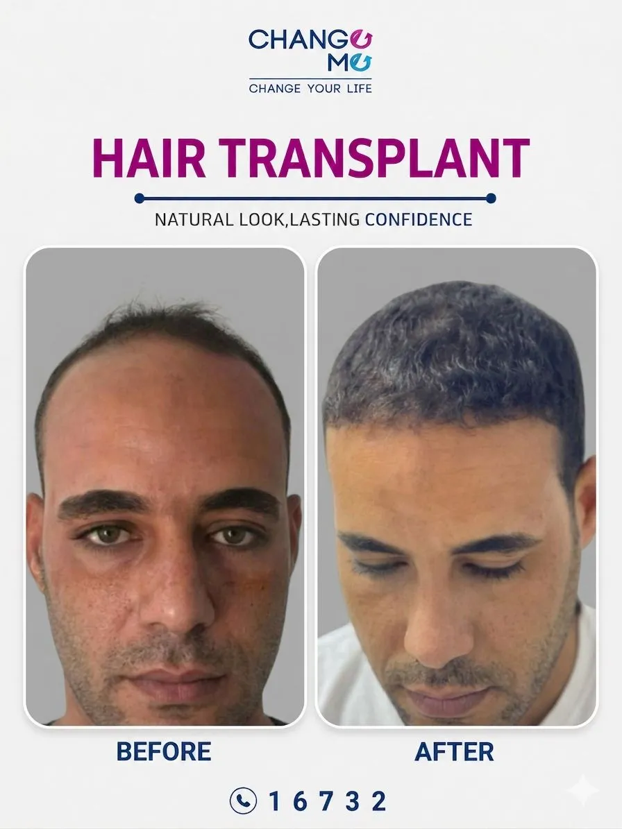 Before and after cosmetic treatment photo of patient 5
