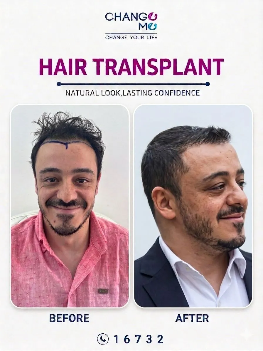 Before and after cosmetic treatment photo of patient 1