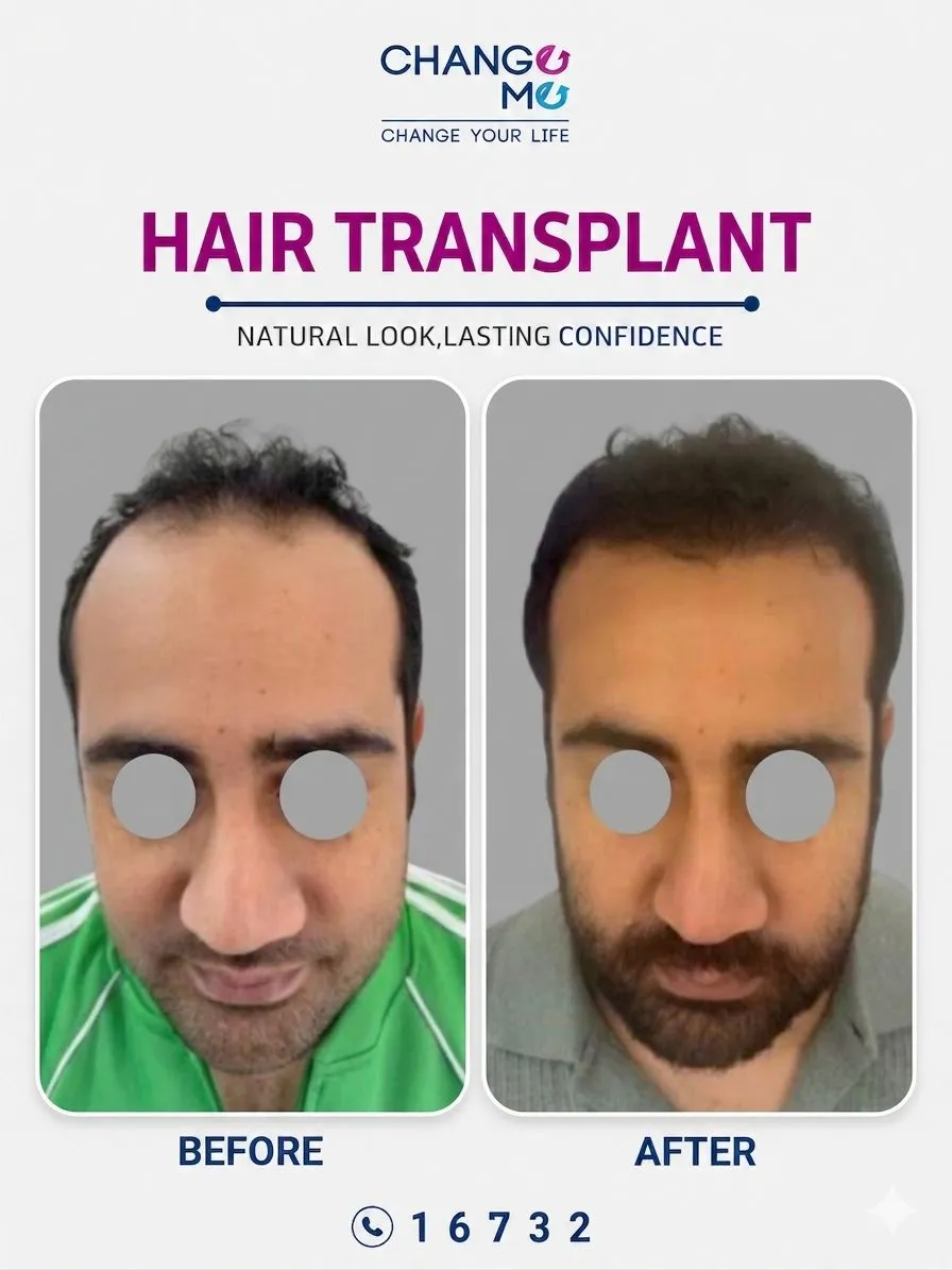 Before and after cosmetic treatment photo of patient 3