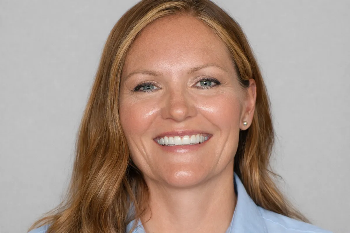 Complete smile transformation before and after