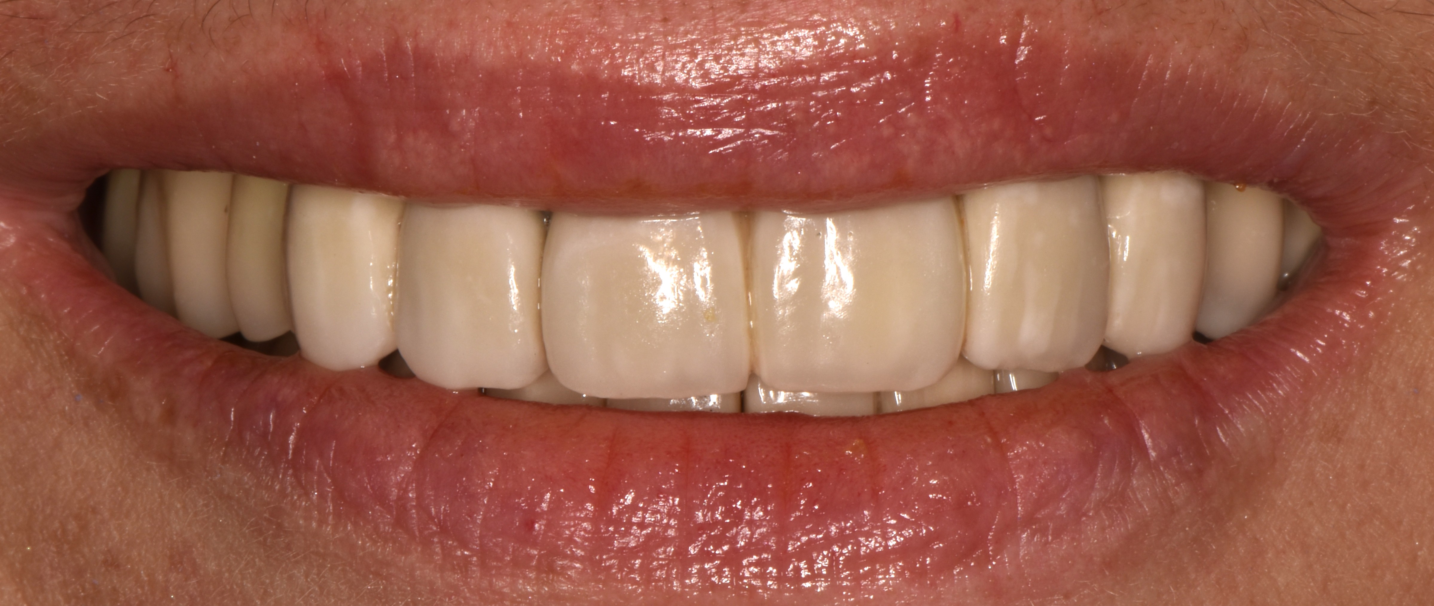 Cosmetic dentistry before and after