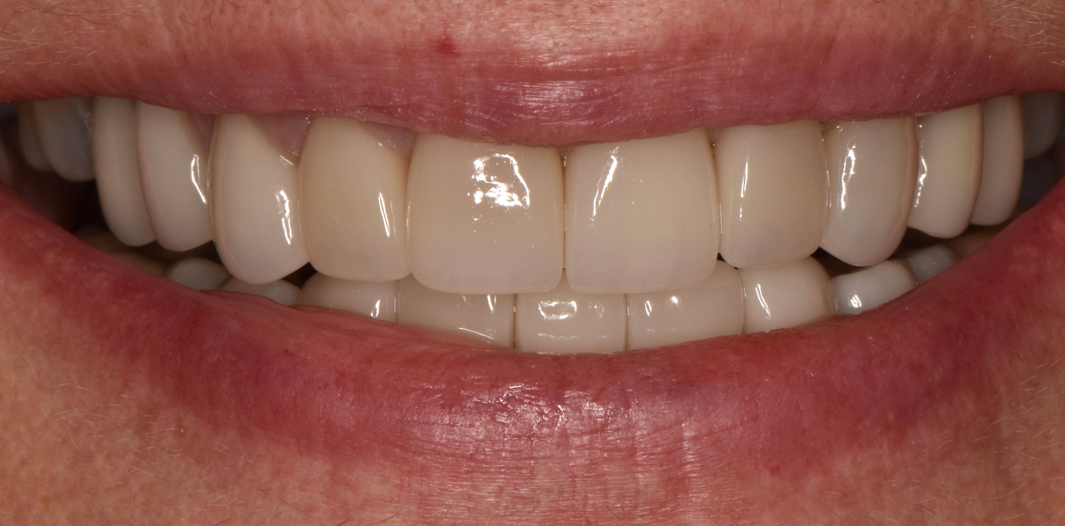 Cosmetic dentistry before and after