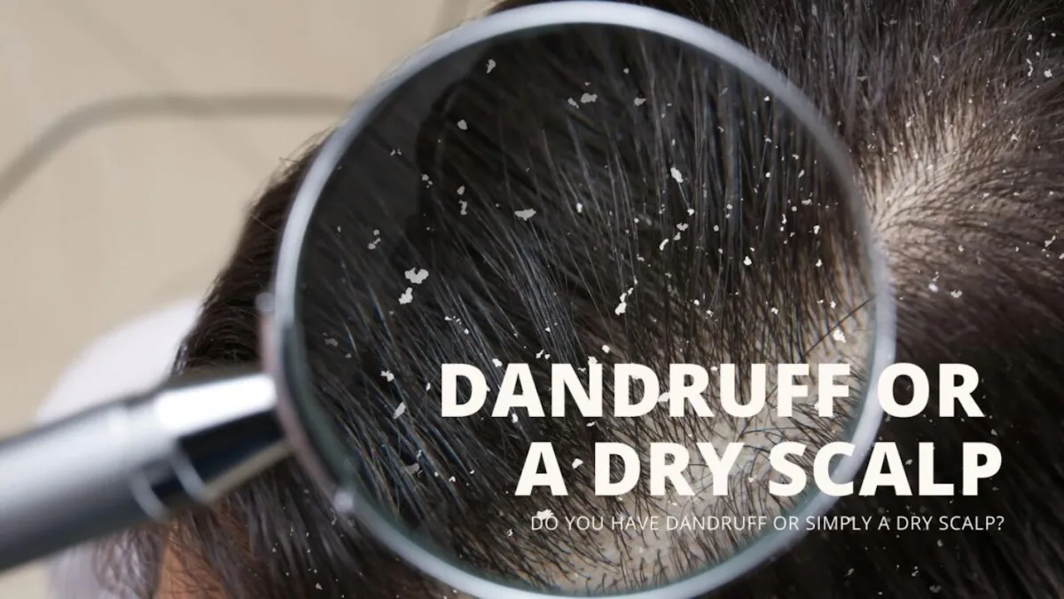Dandruff Test | Kerri Jarrett, Trichology and Epigeentics