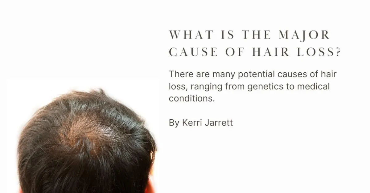 What are The Major Causes of Hair Loss? | Kerri Jarrett, Trichology and Epigentics