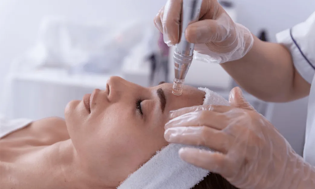 Microneedling Treatment