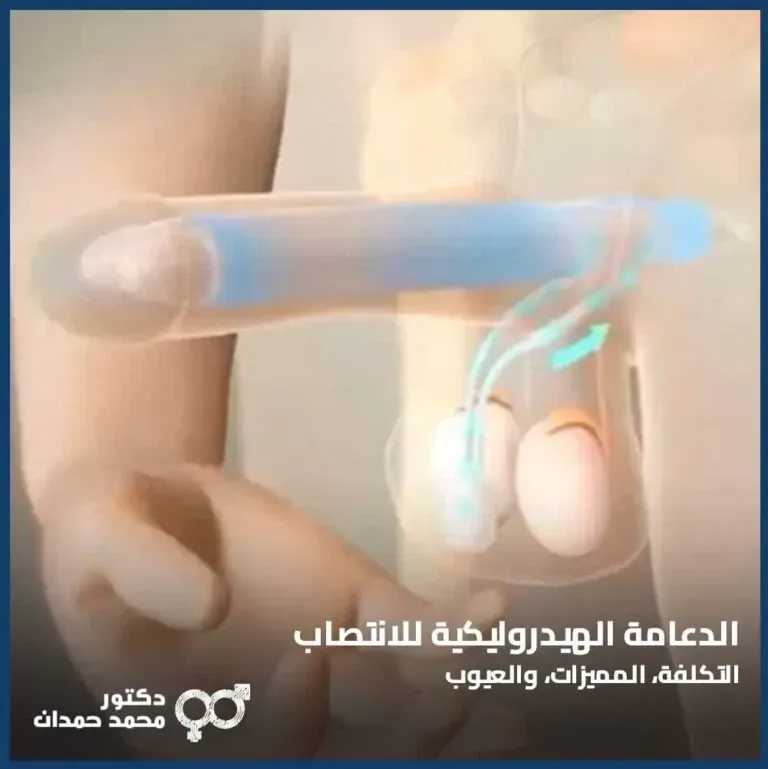الدعامة الهيدروليكية للانتصاب: تعرف على أنواعها ومزاياها