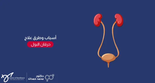 تصميم إعلاني وتوعوي ذو خلفية زرقاء داكنة. يحتوي النصف الأيمن على رسم توضيحي مبسط للجهاز البولي البشري، يظهر كليتين باللون الأحمر في الأعلى، يتصل بكل منهما أنبوب حالب يمتد ليلتقي في الأسفل بالمثانة البولية. في النصف الأيسر، يوجد عنوان باللون الأبيض: "أسباب وطرق علاج"، يليه شكل بيضاوي أحمر بداخله كلمة: "حرقان البول". وفي الزاوية السفلية اليسرى يظهر شعار "مركز التميز لزراعة الدعامات" باللغة الإنجليزية وبجانبه اسم "دكتور محمد حمدان" مع شعاره الطبي.