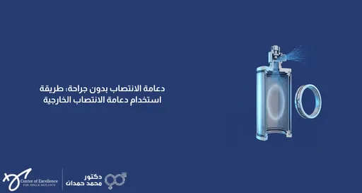 صورة توضيحية لدعامة الانتصاب الخارجية بدون جراحة مع نص "دعامة الانتصاب بدون جراحة: طريقة استخدام دعامة الانتصاب الخارجية"، على خلفية زرقاء تحمل شعار الدكتور محمد حمدان.