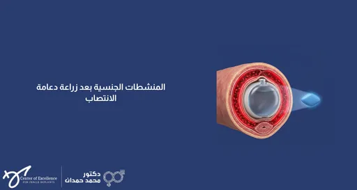 تصميم بخلفية زرقاء داكنة يتضمن على اليمين مجسماً طبياً توضيحياً ومقطعياً يُظهر الأنسجة الداخلية مع زراعة دعامة الانتصاب بداخلها، وبجانبها رسم لحبة دواء زرقاء مضيئة على شكل معين ترمز للمنشطات الجنسية. على اليسار، يظهر نص باللون الأبيض: "المنشطات الجنسية بعد زراعة دعامة الانتصاب". وفي الزاوية السفلية اليسرى تظهر شعارات "Center of Excellence" وعيادة الدكتور محمد حمدان.