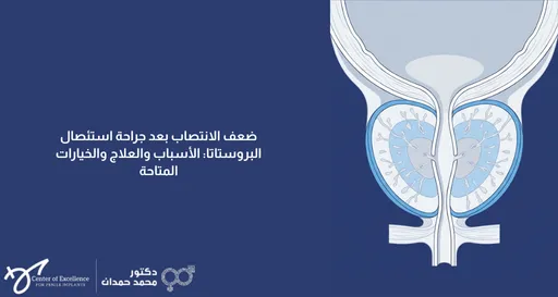 ضعف الانتصاب بعد جراحة استئصال البروستاتا: الأسباب والعلاج والخيارات المتاحة، رسم توضيحي للبروستاتا، شرح دكتور محمد صمدات.