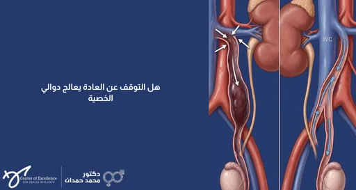 هل التوقف عن العادة يعالج دوالي الخصية – د. محمد حمدان
