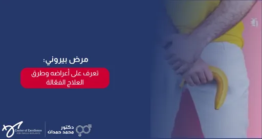 مرض بيروني: تعرف على أعراضه وطرق العلاج الفعّالة، رجل يمسك موزة بشكل توضيحي، شرح دكتور محمد صمدات.