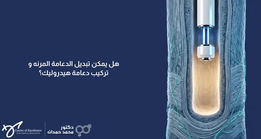 تصميم بخلفية زرقاء داكنة يتضمن على اليمين رسماً طبياً ثلاثي الأبعاد يُظهر مقطعاً طولياً للأنسجة والأوعية الدموية الدقيقة، وبداخلها جزء من آلية دعامة هيدروليكية مضيئة من المنتصف باللون الأصفر والأزرق. على اليسار، يظهر نص باللون الأبيض يتساءل: "هل يمكن تبديل الدعامة المرنه و تركيب دعامة هيدروليك؟". وفي الزاوية السفلية اليسرى تظهر شعارات "Center of Excellence" وعيادة الدكتور محمد حمدان.