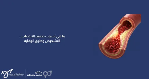 ما هي أسباب ضعف الانتصاب: التشخيص وطرق الوقاية، رسم توضيحي لشريان دموي يوضح ضعف تدفق الدم، شرح دكتور محمد صمدات.