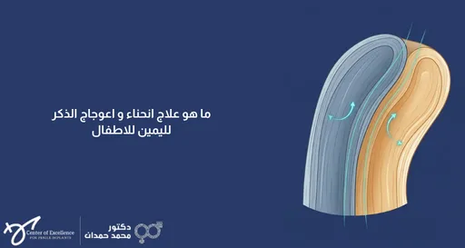 ما هو علاج انثناء واعوجاج ذكر اليمين للأطفال؟ رسم توضيحي لقضيب يمين منحني، شرح دكتور محمد صمدات بمركز التميز.
