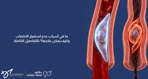 ما هي أسباب عدم استمرار الانتصاب وكيف يمكن علاجها؟ رسم توضيحي لانسداد الأوعية الدموية، شرح دكتور محمد صمدات.