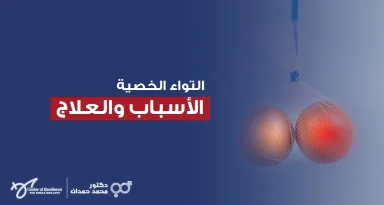 التواء الخصية: الأسباب والعلاج، رسم توضيحي لخصية تعاني من الالتواء مع إبراز الألم، شرح دكتور محمد صمدات.