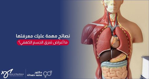 مجسم طبي تشريحي لـجذع الإنسان يظهر الأعضاء الداخلية، بجانبه نص: "نصائح مهمة عليك معرفتها، ما أعراض تمزق الجسم الكهفي؟"، مع شعار الدكتور محمد حمدان.