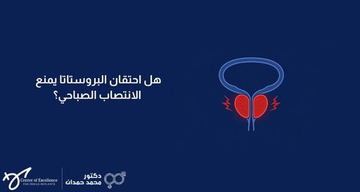 رسم توضيحي طبي لغدة البروستاتا يظهر احتقانها باللون الأحمر، بجانبه نص: "هل احتقان البروستاتا يمنع الانتصاب الصباحي؟"، مع شعار الدكتور محمد حمدان.