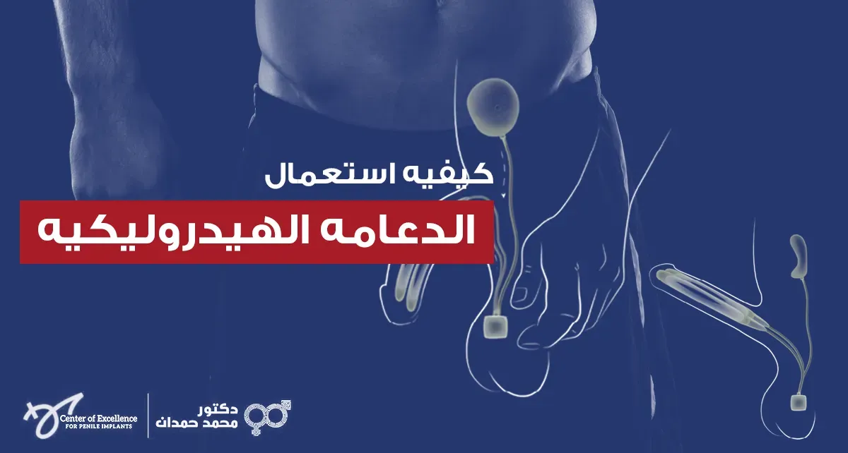 كيفية استعمال الدعامة الهيدروليكية، رسم توضيحي يوضح تركيب الدعامة داخل العضو الذكري، شرح دكتور محمد صمدات.
