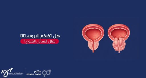 هل تضخم البروستاتا يقلل السائل المنوي؟ رسم توضيحي للمثانة والبروستاتا الطبيعية والمصابة بالتضخم، شرح دكتور محمد صمدات.