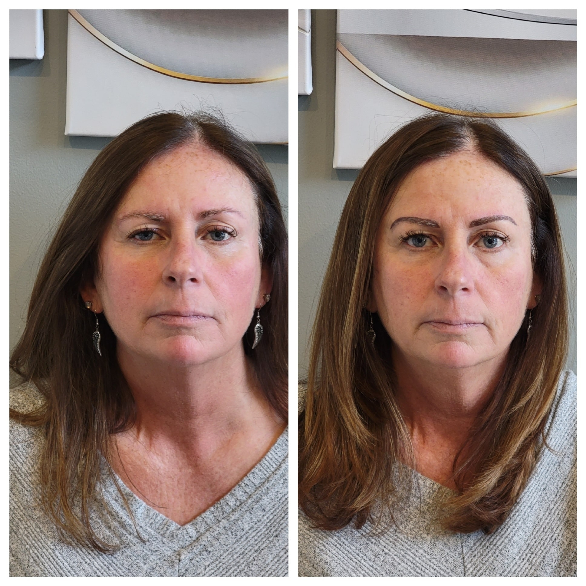 A Combination Brows Look Like While Healing