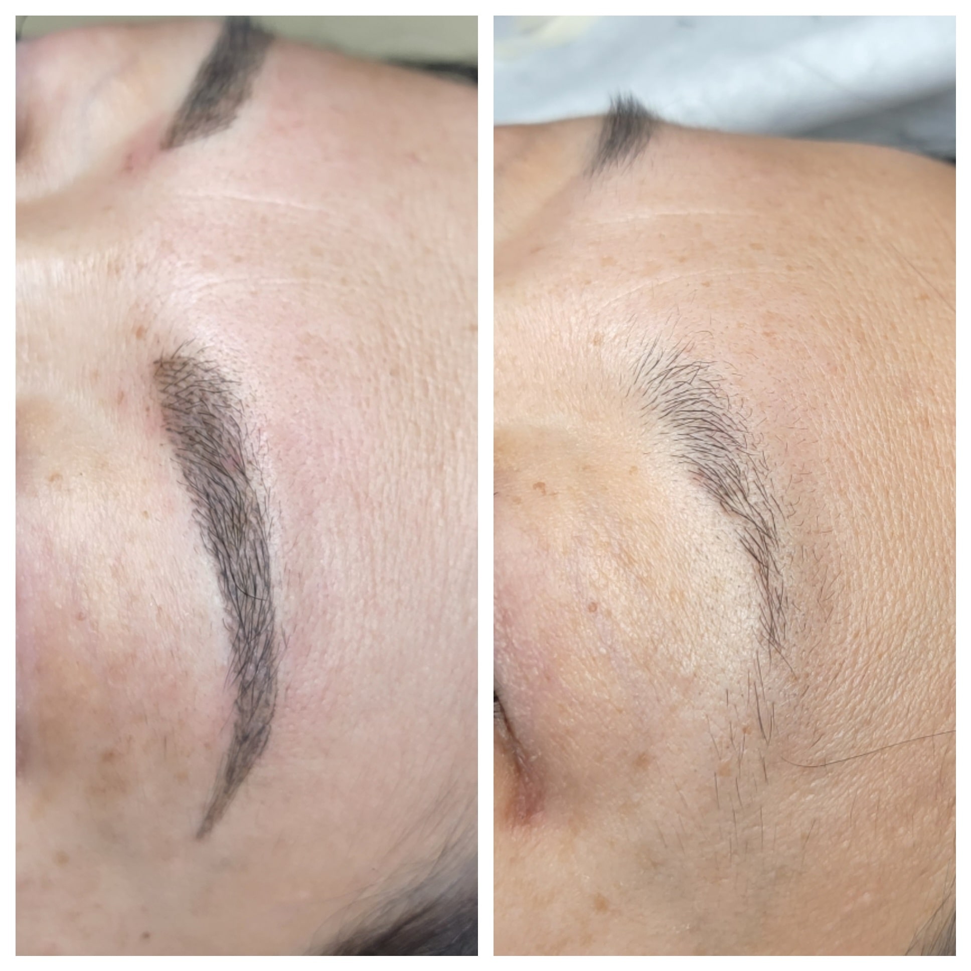 Eyebrow Healing & Aftercare in Londonderry, NH