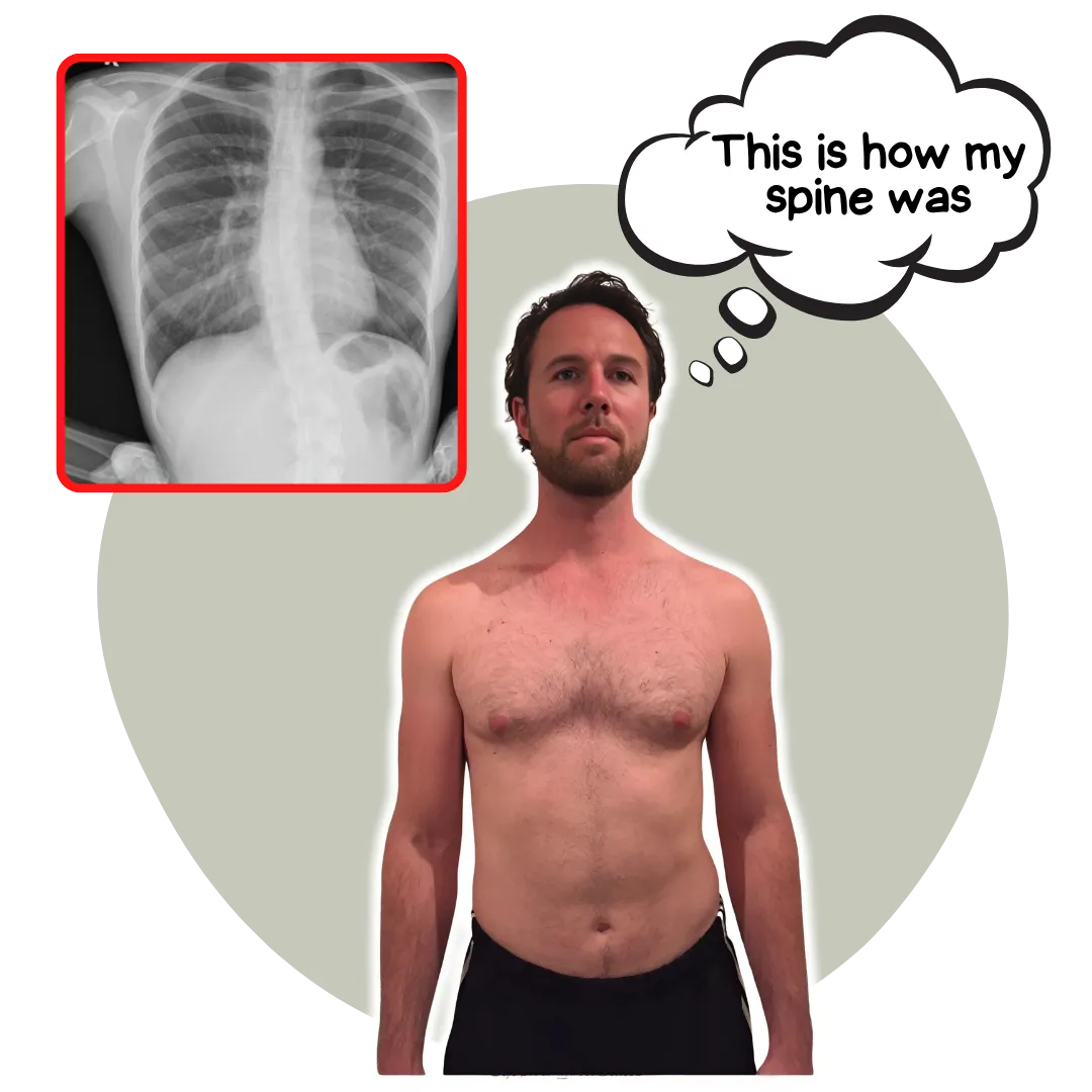 How to exercise with chronic pain - Movement Monk
