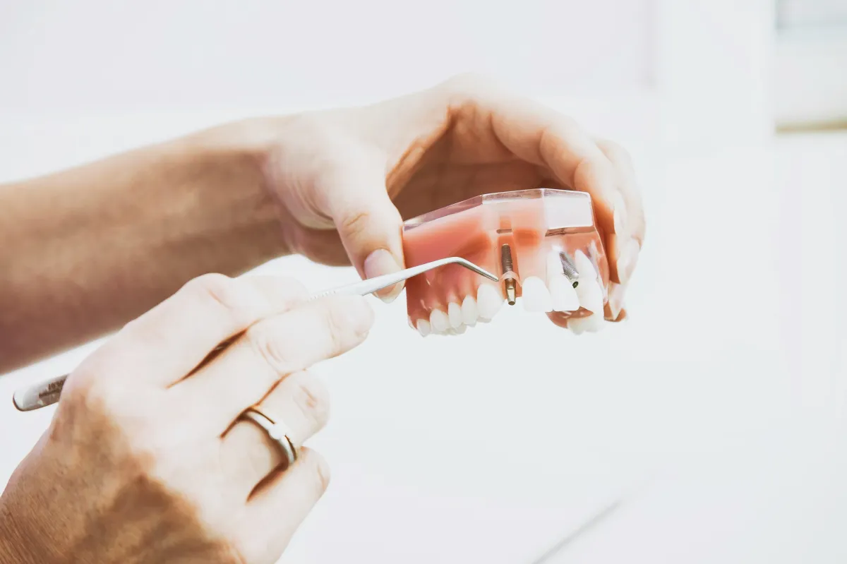 Example of a dental implant