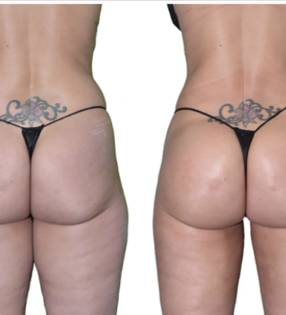 Aesthetic Injectables