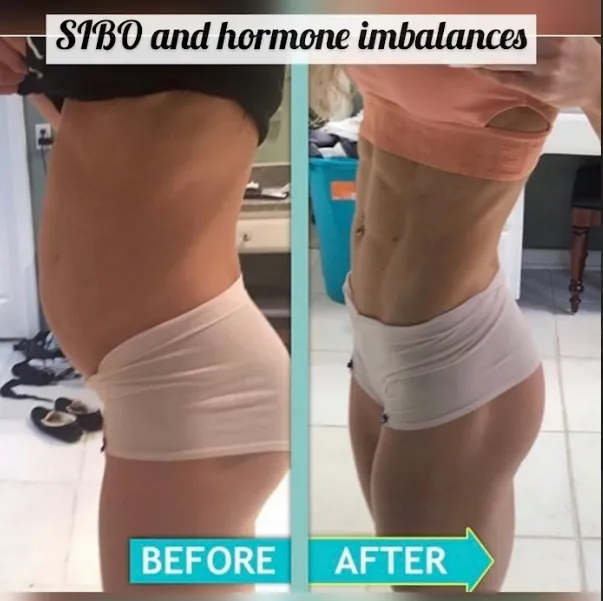 Client before and after resolving hormonal root cause