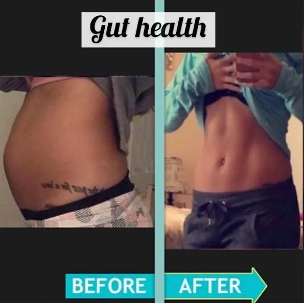Client before and after resolving dysbiosis