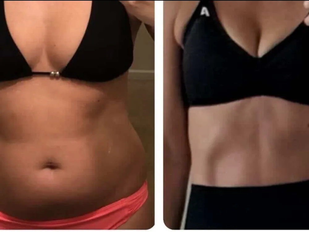 Client before and after resolving hormonal root cause