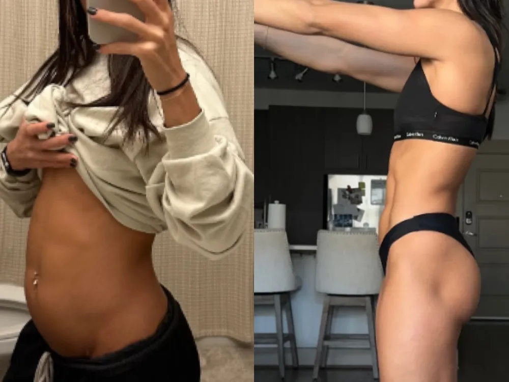 Client before and after resolving low stomach acid