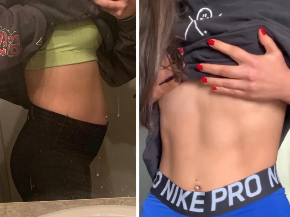Client before and after resolving dysbiosis